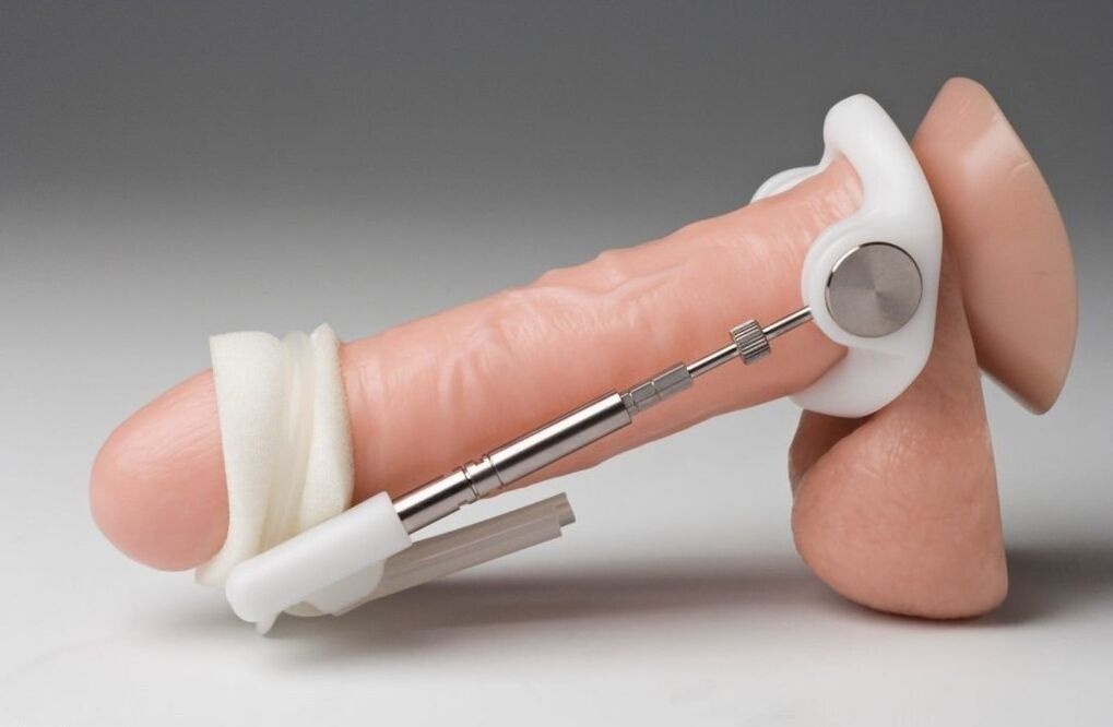 Extender will increase the thickness of the penis